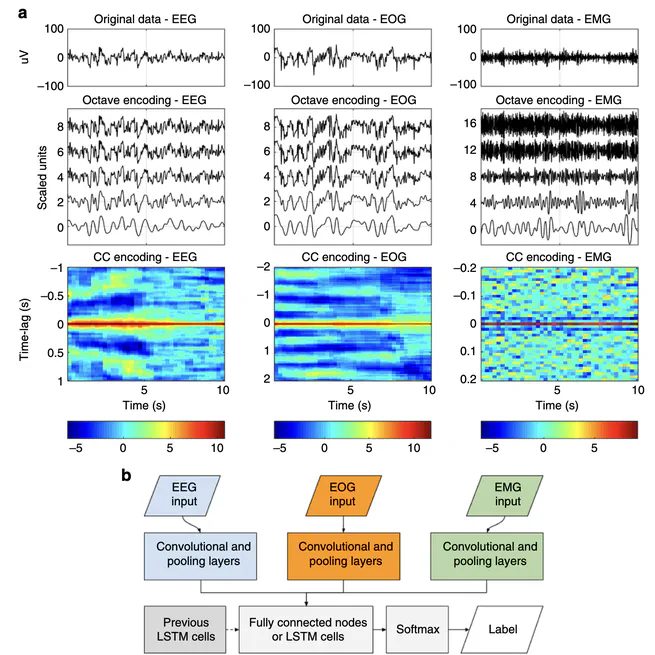 Neural Network Analysis of Sleep Stages Enables Efficient Diagnosis of Narcolepsy