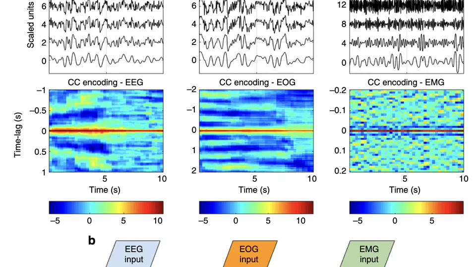 Neural Network Analysis of Sleep Stages Enables Efficient Diagnosis of Narcolepsy